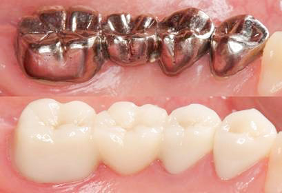 �⎕�Ɣ������̃u���b�W