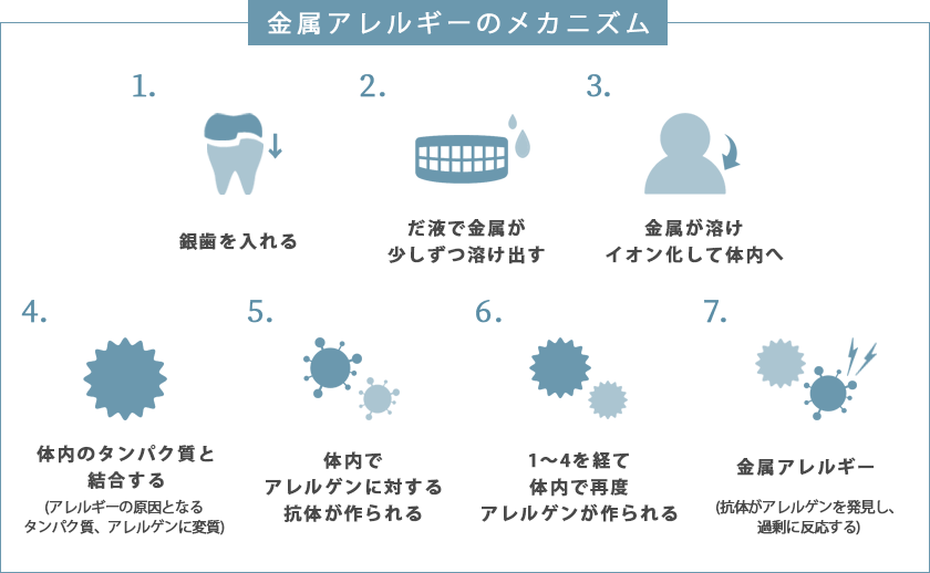 金属アレルギーのメカニズム