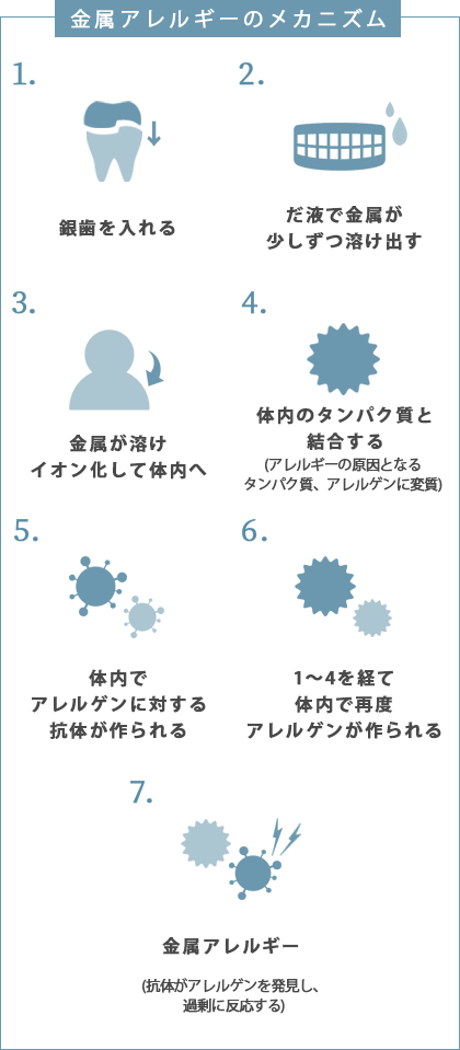金属アレルギーのメカニズム