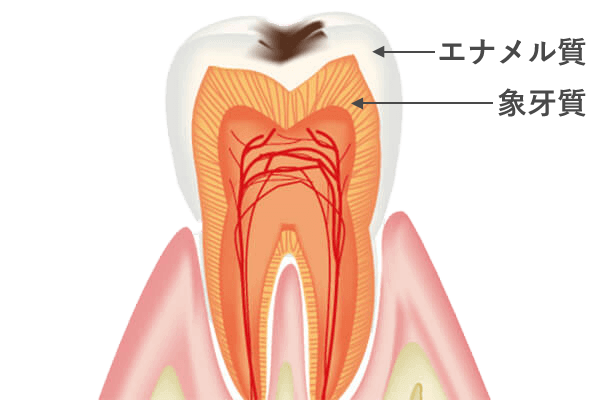 FC1